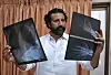 Journalist Kadafi Zaman studerer røntgenbilete av ribbein og hender etter at han vart lauslaten i Pakistan i juli 2018.